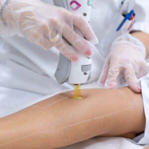 depilacion laser zaragoza
